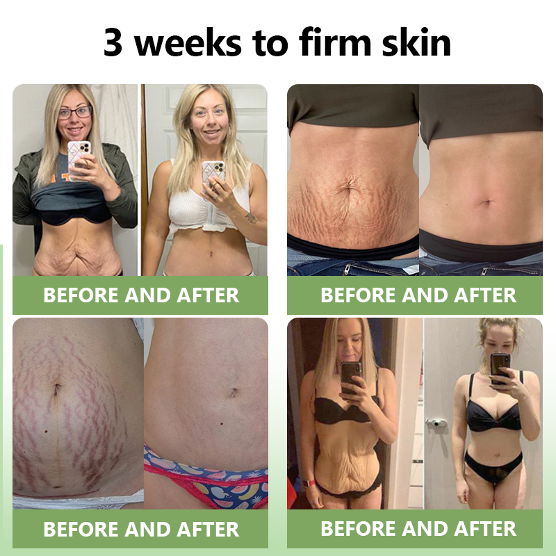 Luxurious Collagen Firming Cream(🔥80% Off for a Limited Time!)🥑