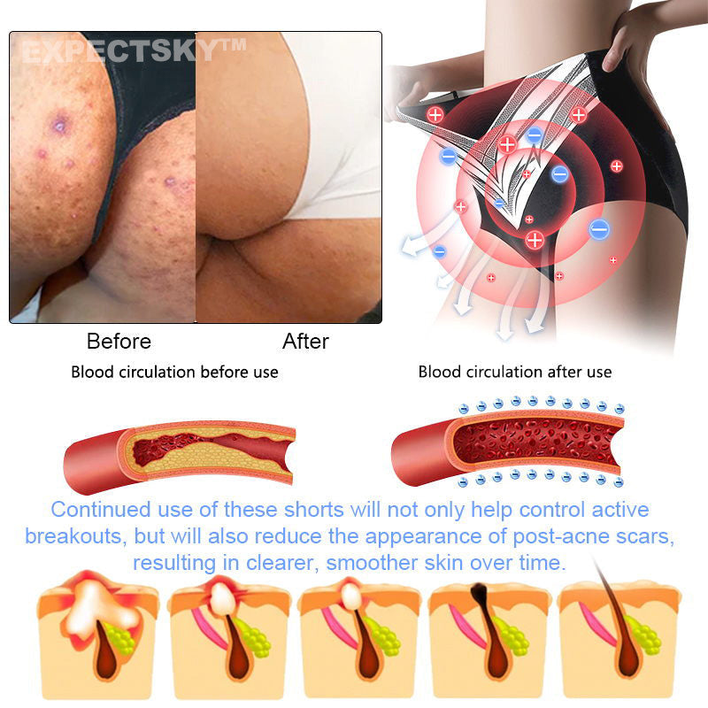 Medical Grade Titanium Fiber Self-heating Tourmaline Shaping Shorts👙