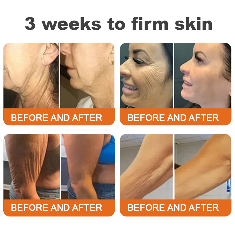 Made and shipped from Ireland |Awzlove® Botox Bee Venom Rapid Skin Repair Cream| LAST DAY 80% OFF🐝