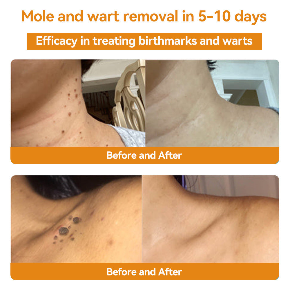 ๐๐ข๐๐๐๐ขโข Bee Venom Skin Treatment Cream๏ผEDQM ๐
๐๐๐๐๐๐๐๐๐๐๏ผ