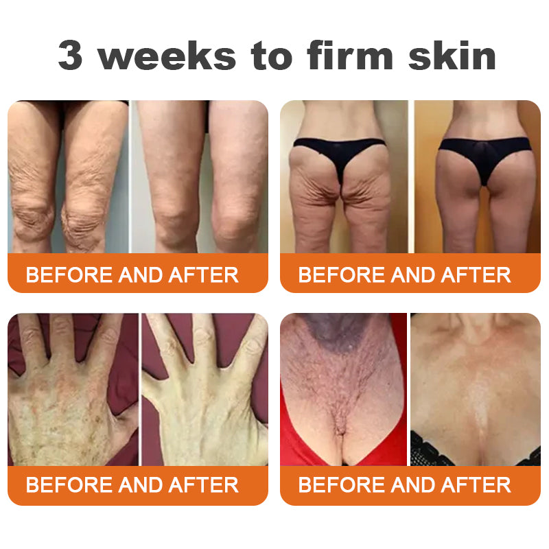 Made and shipped from Ireland |Awzlove® Botox Bee Venom Rapid Skin Repair Cream| LAST DAY 80% OFF🐝
