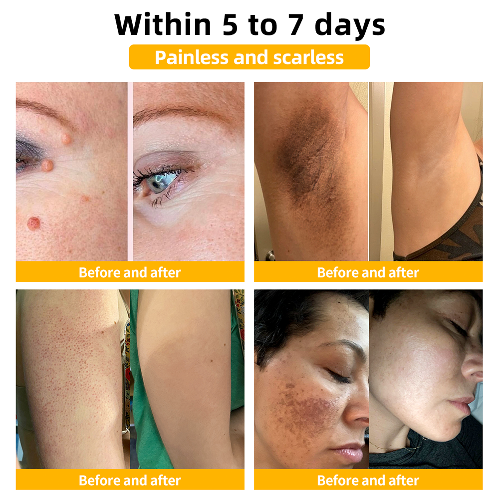 ๐๐ข๐๐๐๐ขโข Bee Venom Skin Treatment Cream๏ผEDQM ๐
๐๐๐๐๐๐๐๐๐๐๏ผ