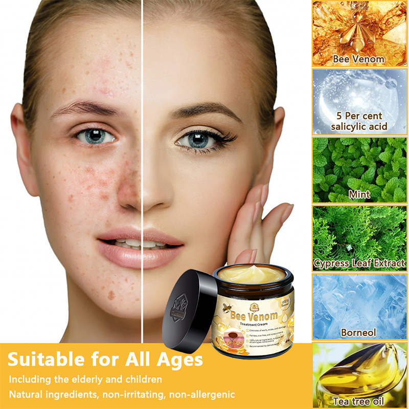 Turonu™ Bee Venom Skin Cream is approved by the Irish Association of Dermatology (IAD) (helps treat acne, warts, rosacea, psoriasis, age spots, eczema and reduces the appearance of stretch marks)🌿