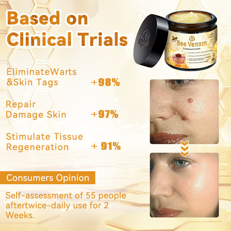 Turonu™ Bee Venom Skin Cream is approved by the Irish Association of Dermatology (IAD) (helps treat acne, warts, rosacea, psoriasis, age spots, eczema and reduces the appearance of stretch marks)🌿
