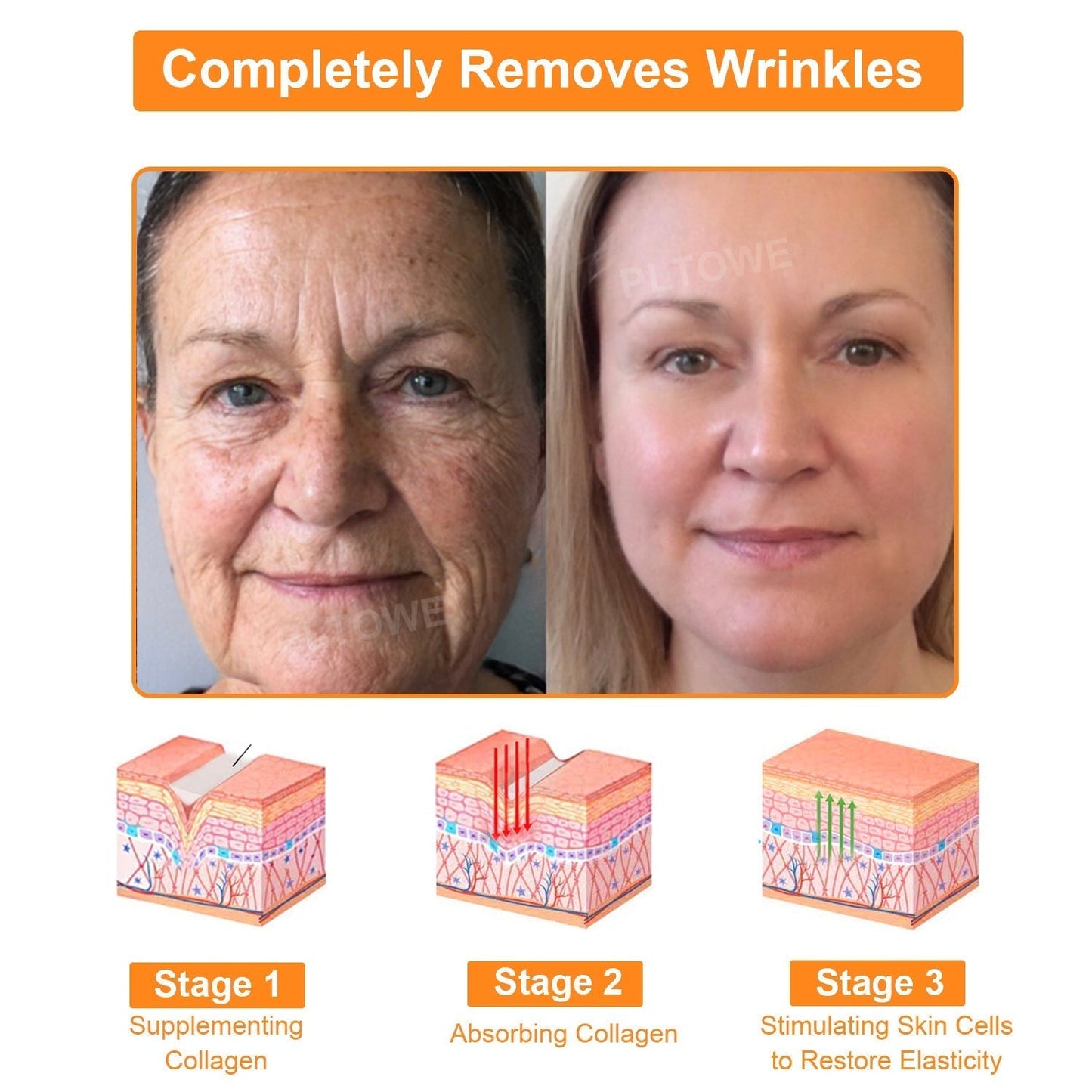 Awzlove™ Powerful All-Body Skin Treatment Cream (EMA Recommended)