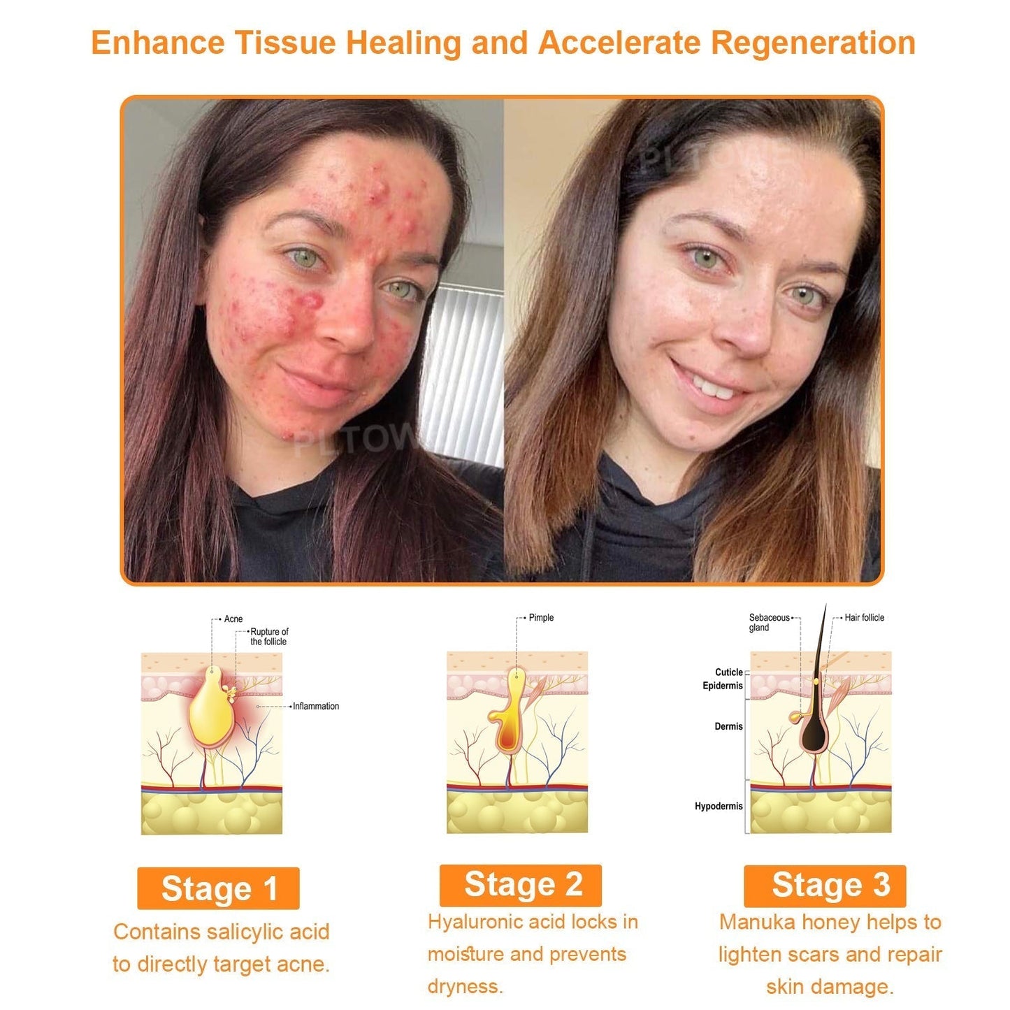 Awzlove™ Powerful All-Body Skin Treatment Cream (EMA Recommended)