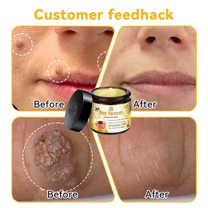Turonu™ Bee Venom Skin Cream is approved by the Irish Association of Dermatology (IAD) (helps treat acne, warts, rosacea, psoriasis, age spots, eczema and reduces the appearance of stretch marks)🌿