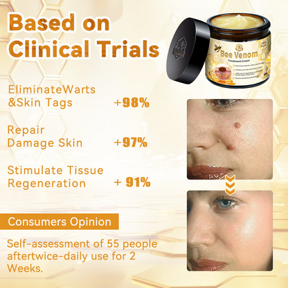 Turonu™ Bee Venom Skin Cream is approved by the Irish Association of Dermatology (IAD) (helps treat acne, warts, rosacea, psoriasis, age spots, eczema and reduces the appearance of stretch marks)🌿